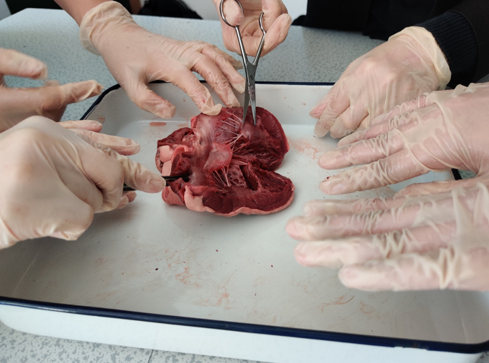Photograph showing multiple hands wearing gloves dissecting a dark red organ, likely a heart, placed on a white tray with a blue rim. Scissors and forceps are used to explore internal structures, indicating a biological or anatomical study or demonstration.