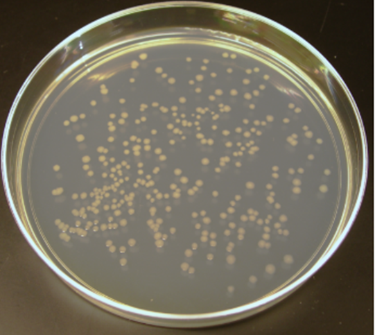 A petri dish with bacteria 