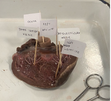 a heart labelled